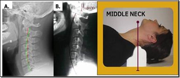 Cervical traction device image
